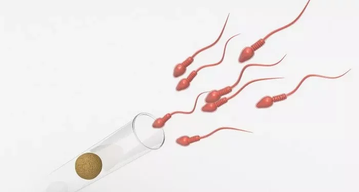 Obstructive Azoospermia Treatment: Helping Achieve Pregnancy