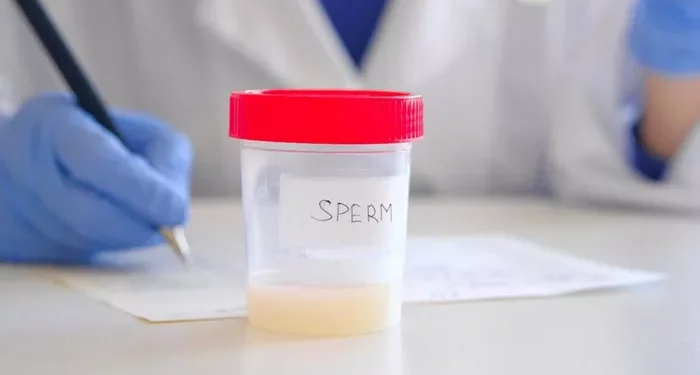Yellow Semen