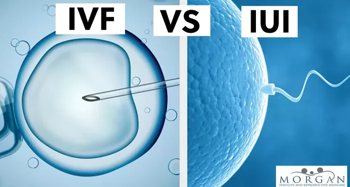 what is the meaning of iui and ivf