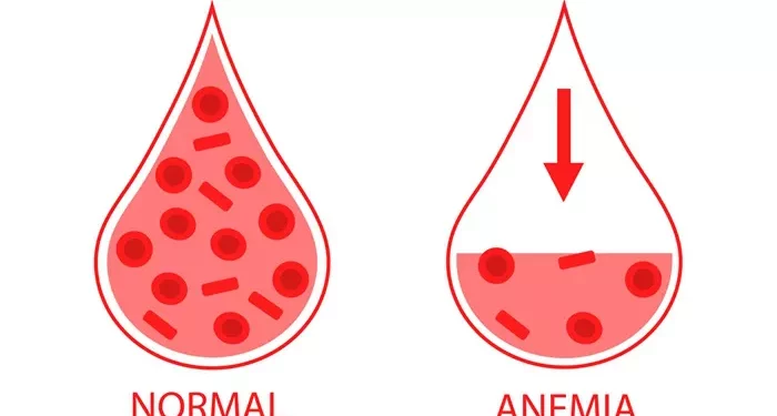 Does Low Hemoglobin Have Any Impact on Infertility?